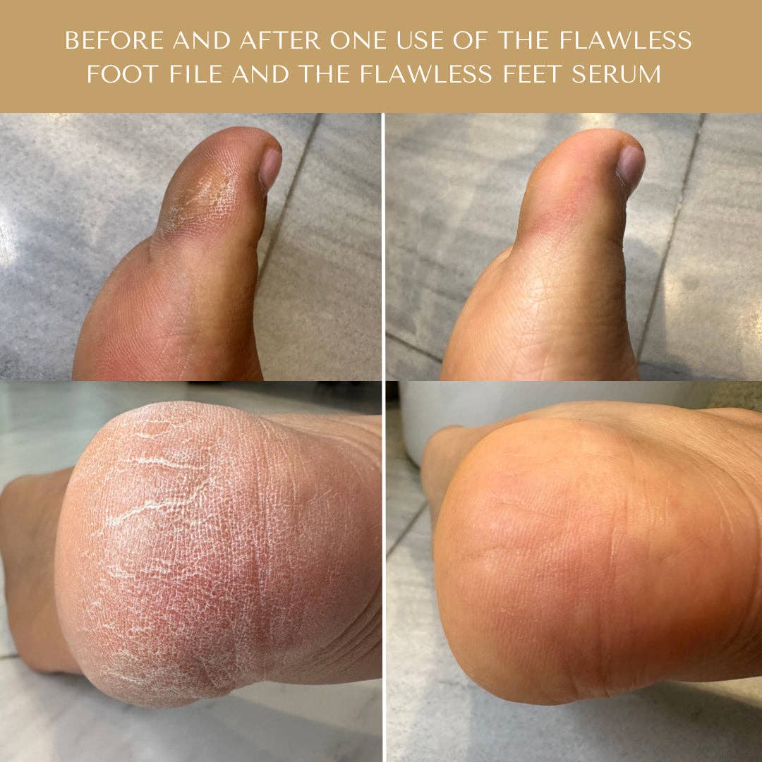 Flawless Feet Serum